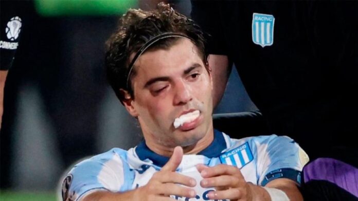 1010x567_santiago-sosa-racing-lesion-532963-100233