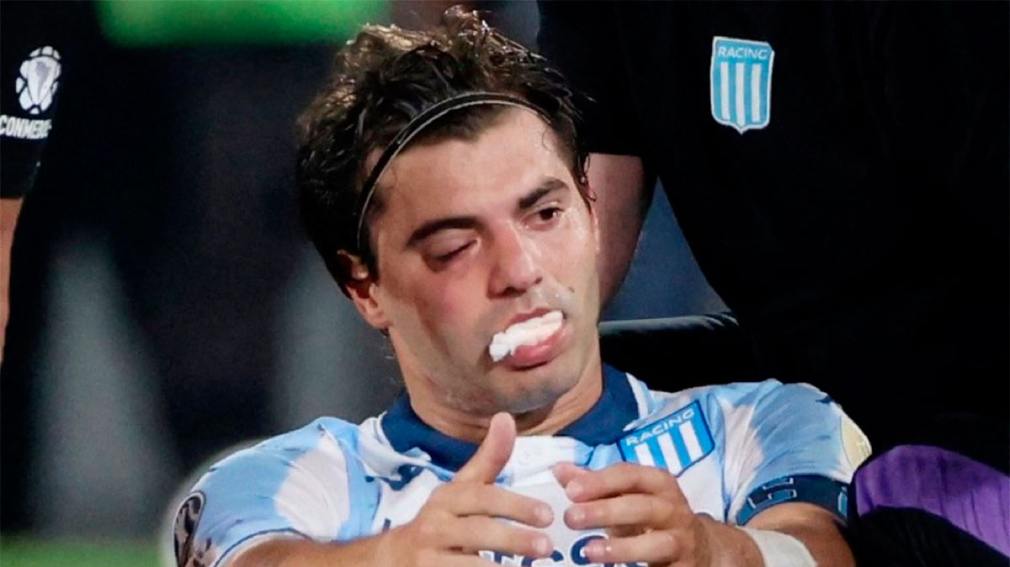 1010x567_santiago-sosa-racing-lesion-532963-100233