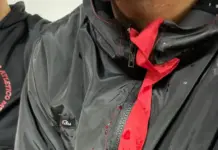 Rompió el silencio uno de los jugadores de Patronato atacado por la barra: «Me dieron con la culata de un arma»